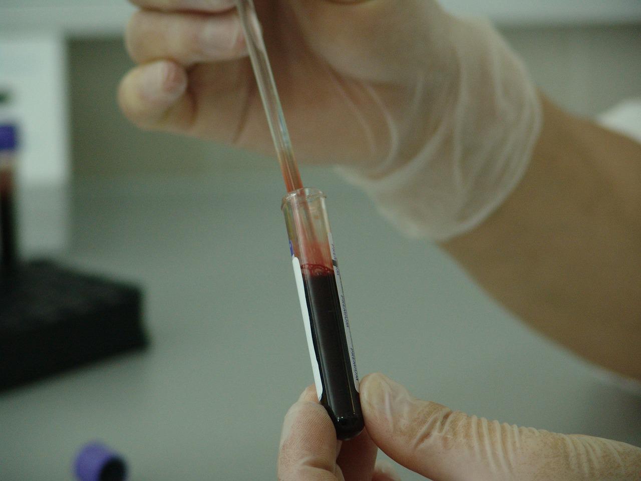blood analisys for better cancer treatment